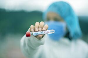  Gdańsk zakupił kolejne testy na koronawirusa dla służb walczących z epidemią